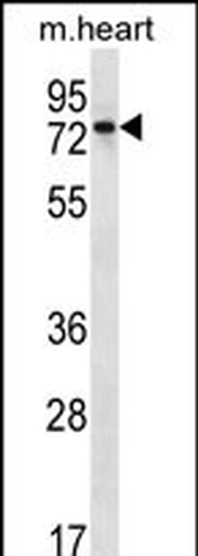 PARP2 Antibody in Western Blot (WB)