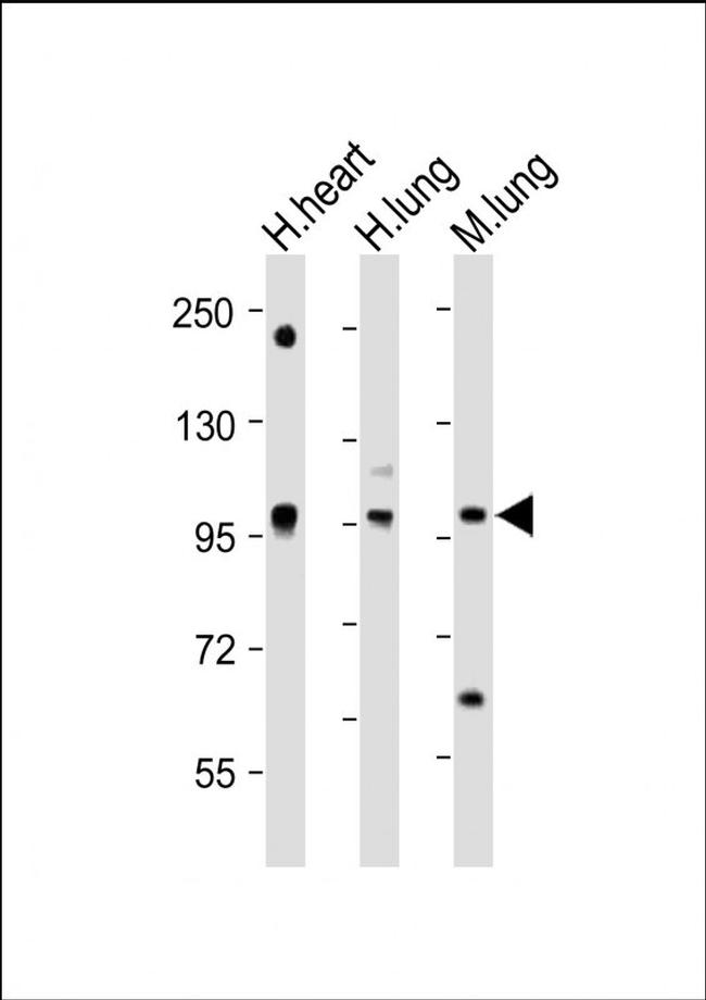 SPON1 Antibody in Western Blot (WB)