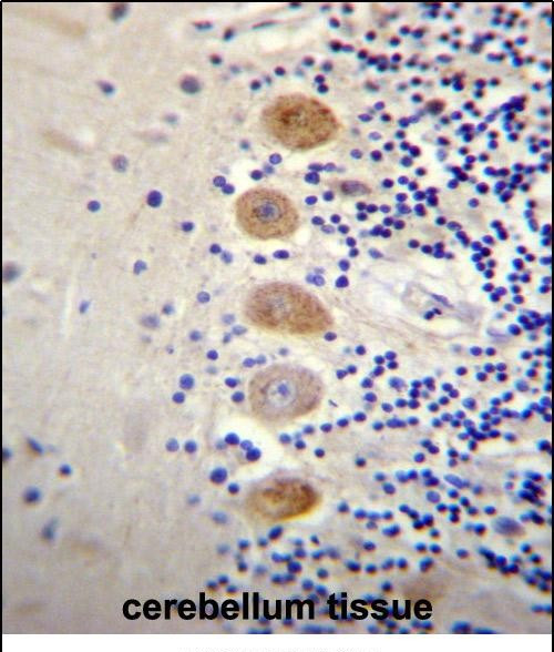 GPR111 Antibody in Immunohistochemistry (Paraffin) (IHC (P))