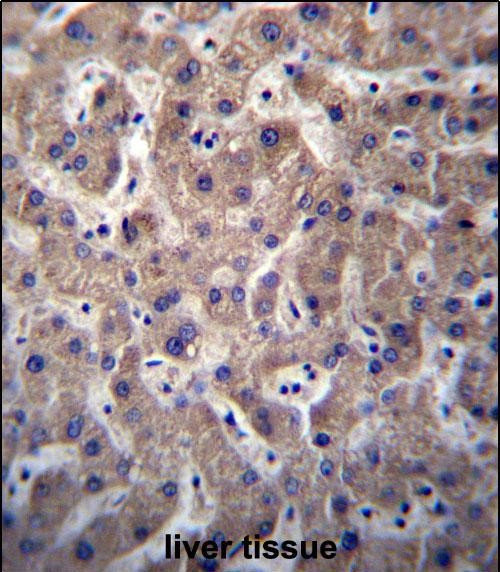 SULT1A3/SULT1A4 Antibody in Immunohistochemistry (Paraffin) (IHC (P))