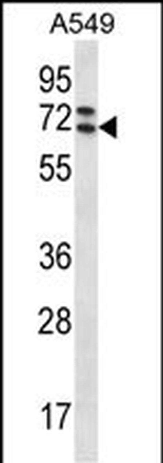 PIK3AP1 Antibody in Western Blot (WB)