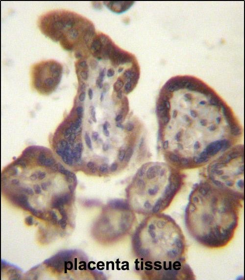 hCG beta Antibody in Immunohistochemistry (Paraffin) (IHC (P))