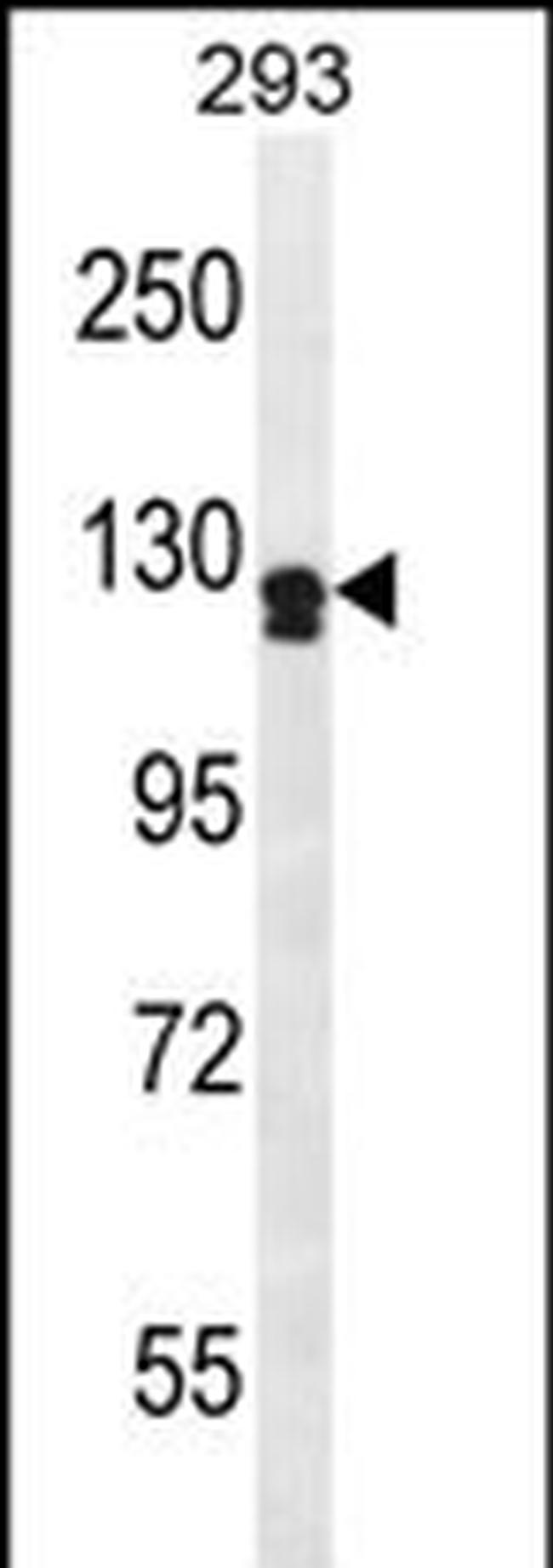 UNC5D Antibody in Western Blot (WB)