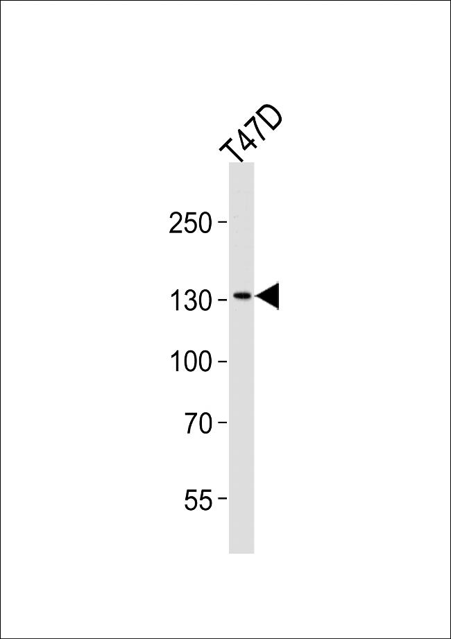 ATAD2 Antibody in Western Blot (WB)