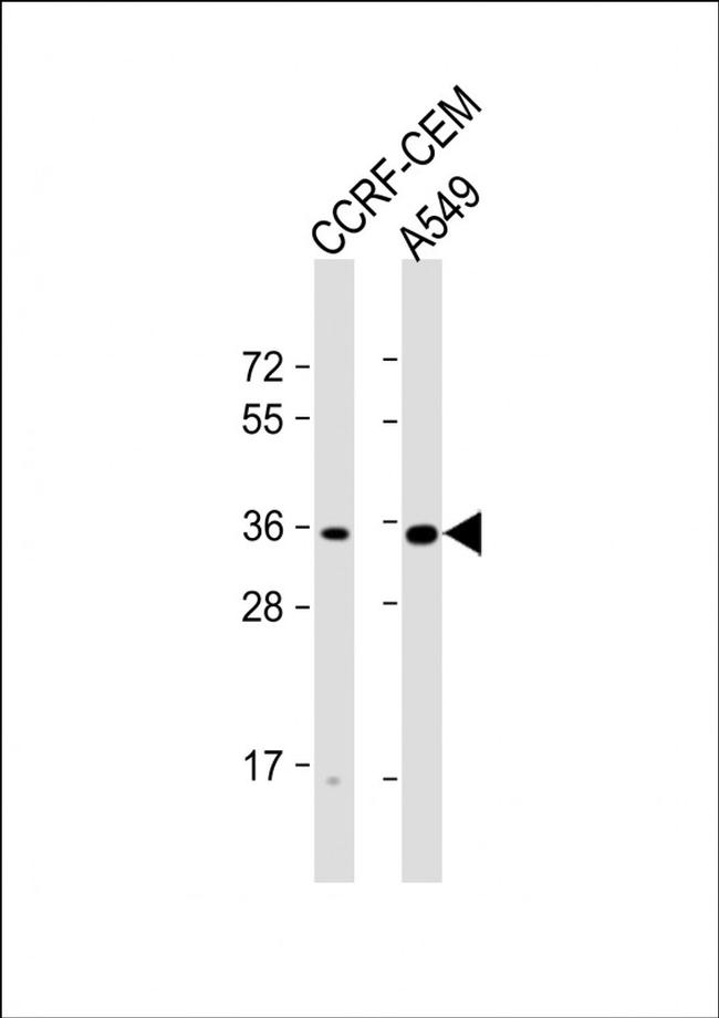 OR2A42 Antibody in Western Blot (WB)