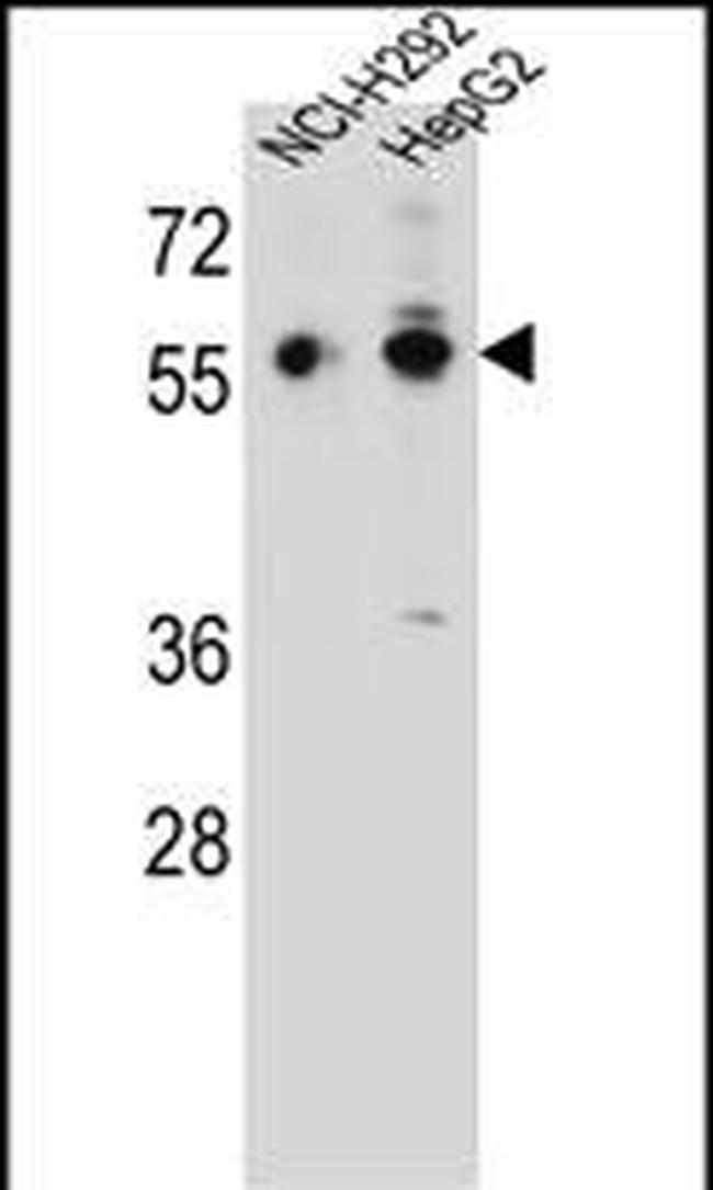 TRIM64 Antibody in Western Blot (WB)