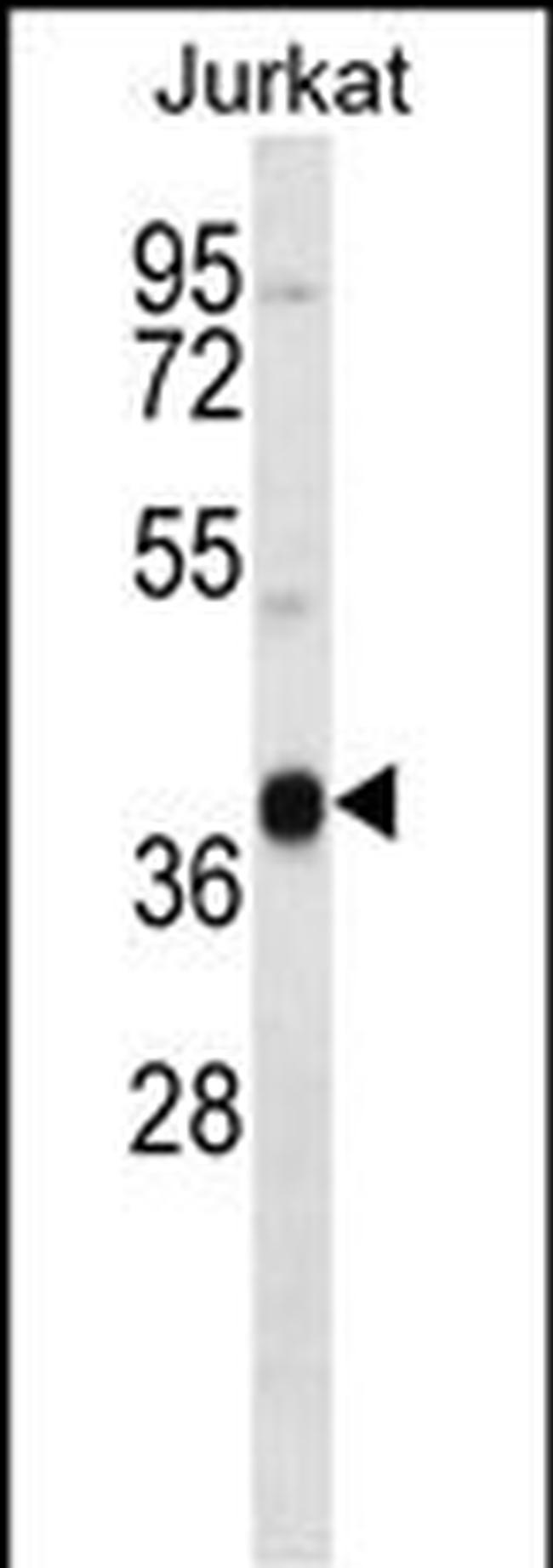 MARCH4 Antibody in Western Blot (WB)