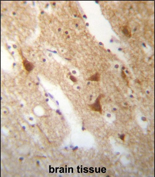 HuC Antibody in Immunohistochemistry (Paraffin) (IHC (P))