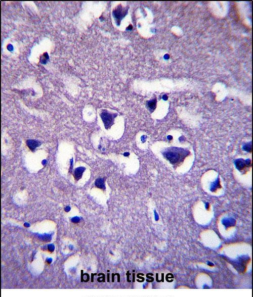 CCDC117 Antibody in Immunohistochemistry (Paraffin) (IHC (P))
