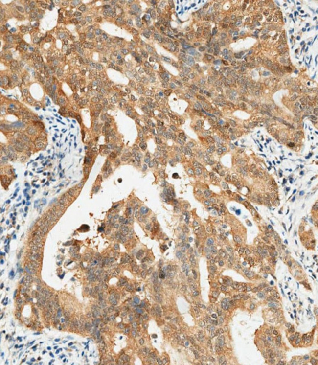 NY-ESO-1 Antibody in Immunohistochemistry (Paraffin) (IHC (P))