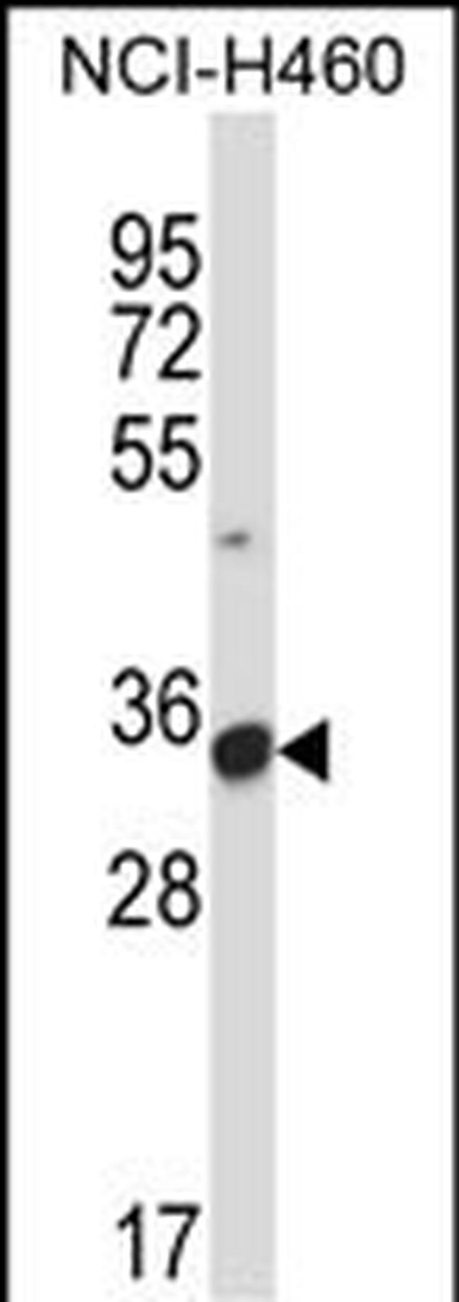 CD16 Antibody in Western Blot (WB)