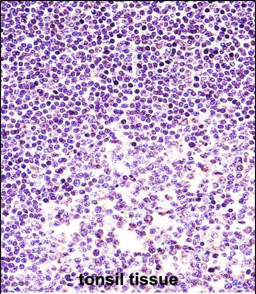 Histone H2A.X Antibody in Immunohistochemistry (Paraffin) (IHC (P))