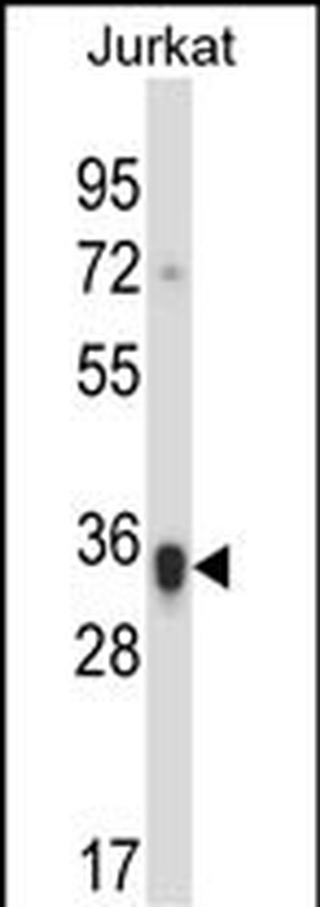 KIR2D Antibody in Western Blot (WB)
