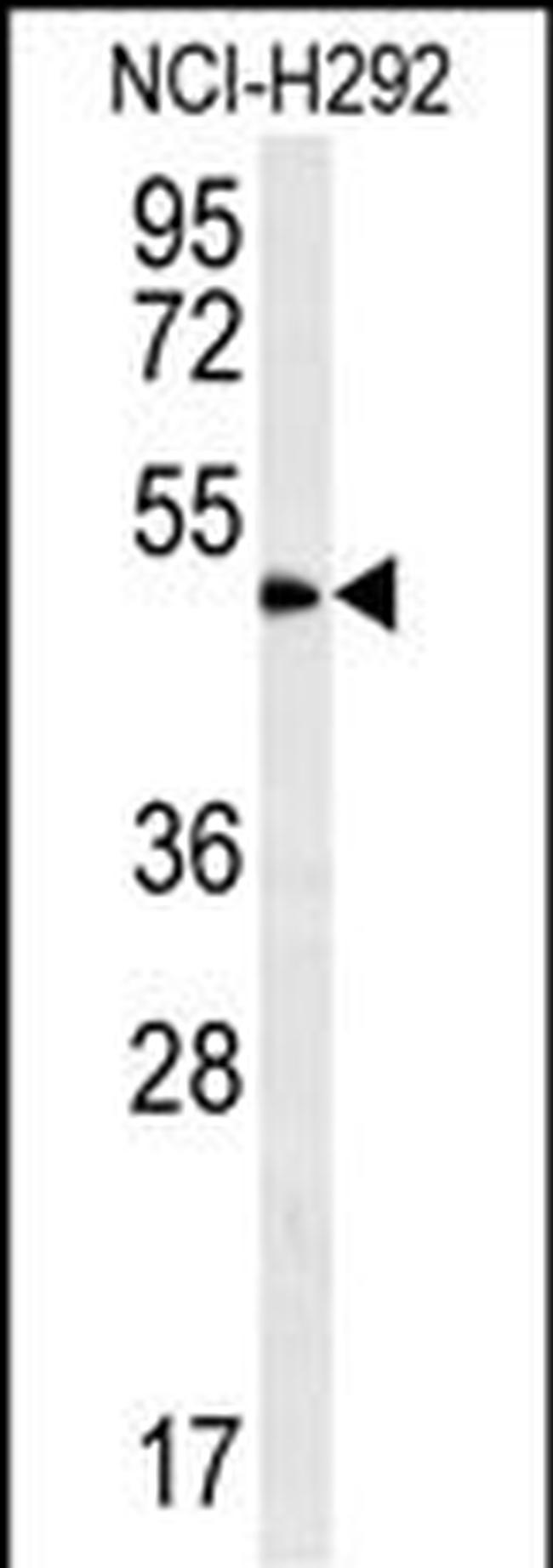 ZNF154 Antibody in Western Blot (WB)