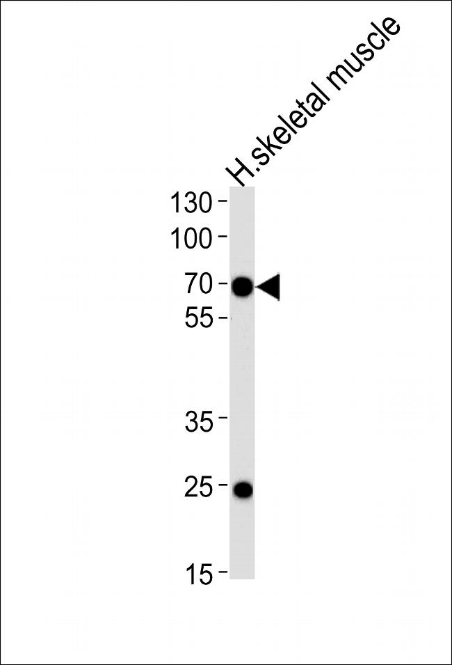 FAM198B Antibody in Western Blot (WB)
