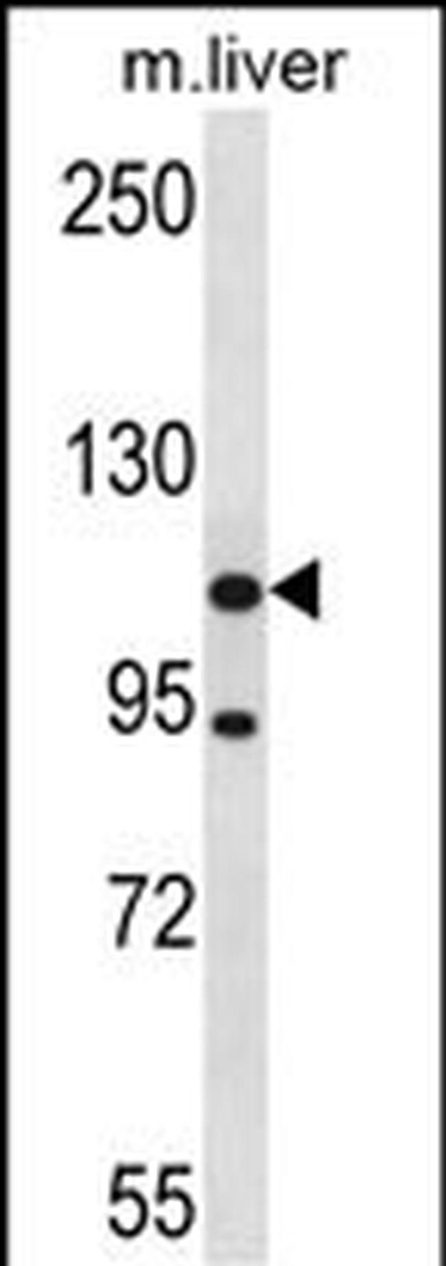 ADNP2 Antibody in Western Blot (WB)