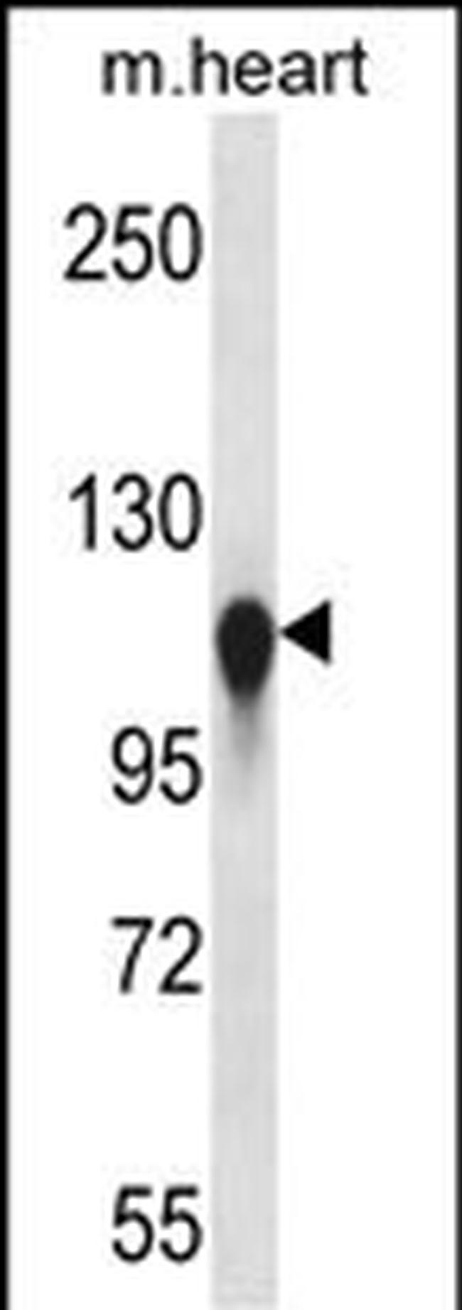 Kinesin 5C Antibody in Western Blot (WB)