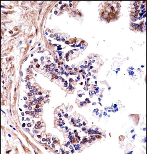 TMPRSS13 Antibody in Immunohistochemistry (Paraffin) (IHC (P))