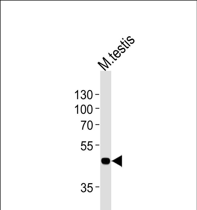 MOS Antibody in Western Blot (WB)