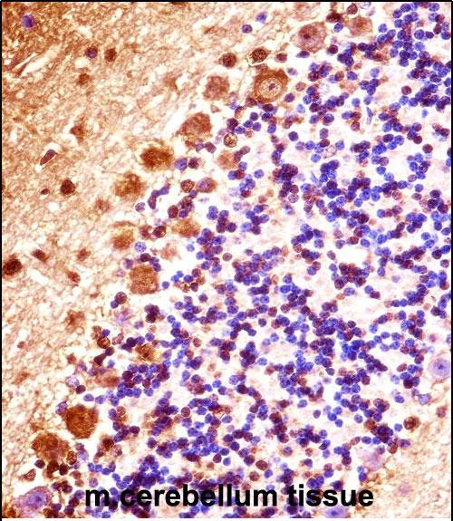 STK32B Antibody in Immunohistochemistry (Paraffin) (IHC (P))