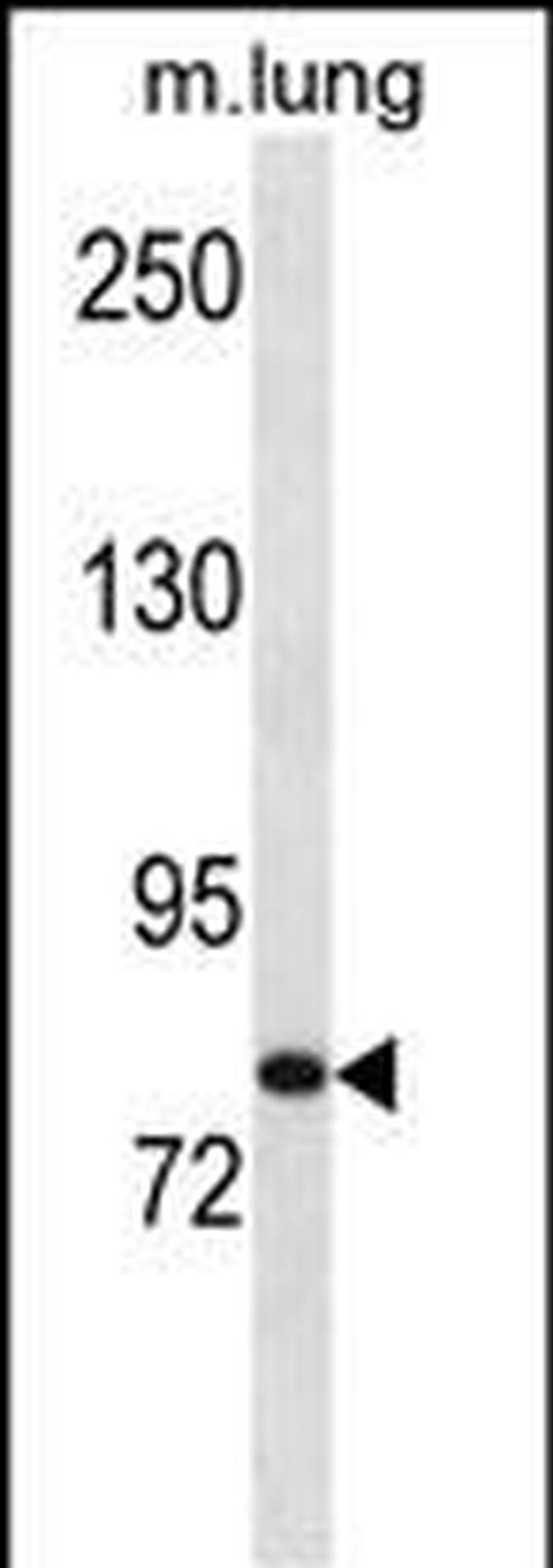 HUNK Antibody in Western Blot (WB)
