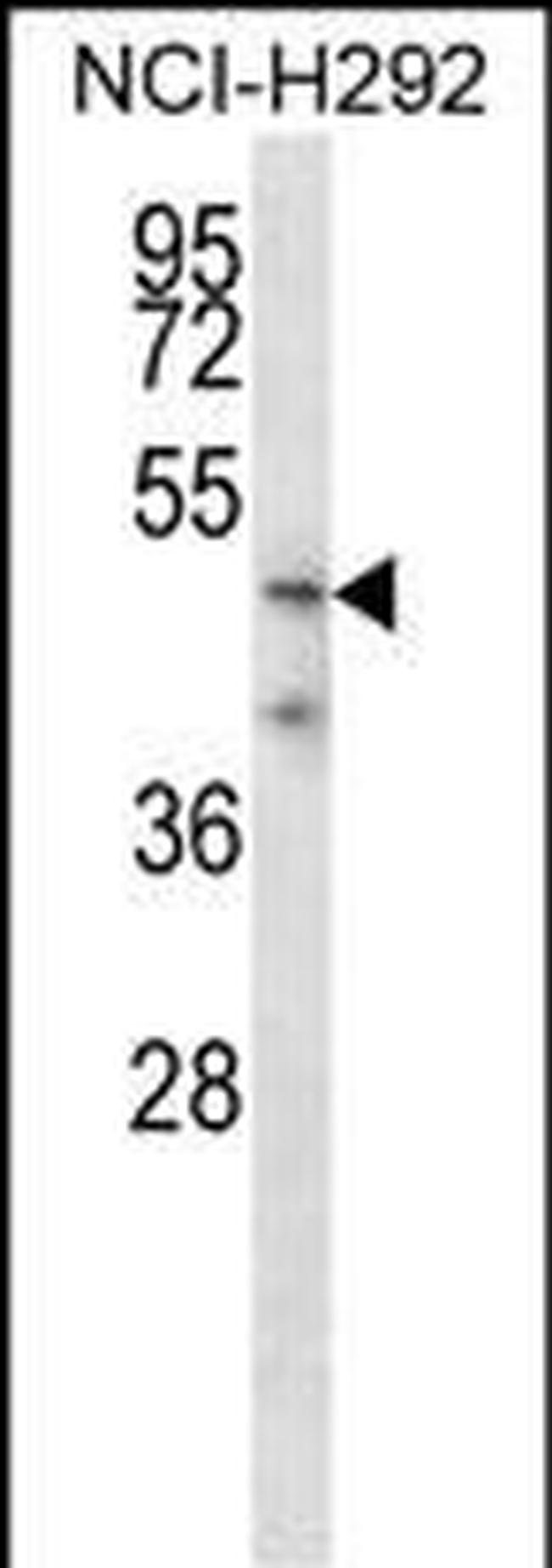 Spinesin Antibody in Western Blot (WB)