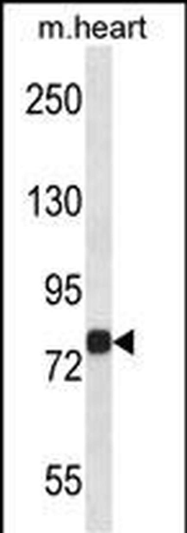 MAP4K2 Antibody in Western Blot (WB)