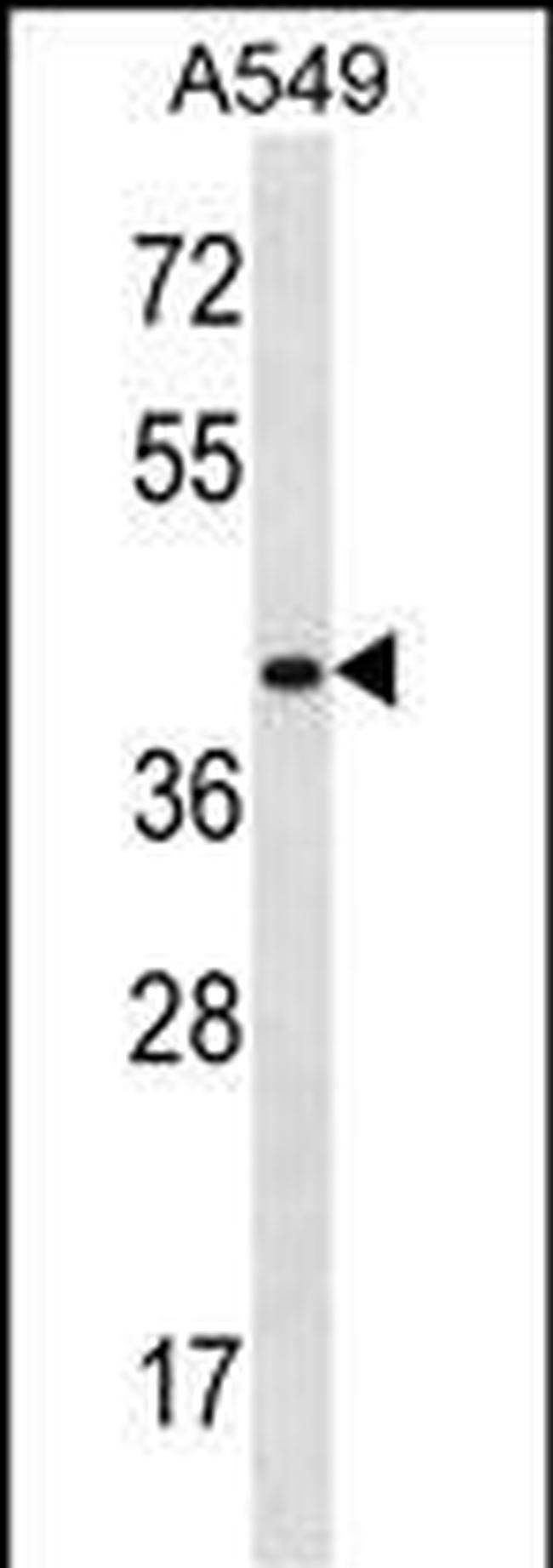 HOXD11 Antibody in Western Blot (WB)