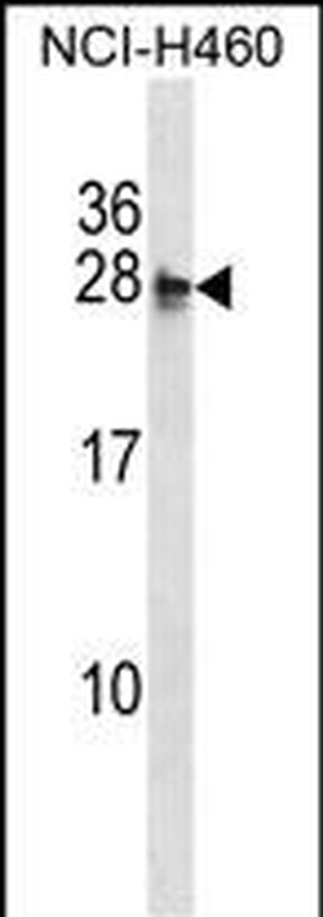 MOCS2 Antibody in Western Blot (WB)