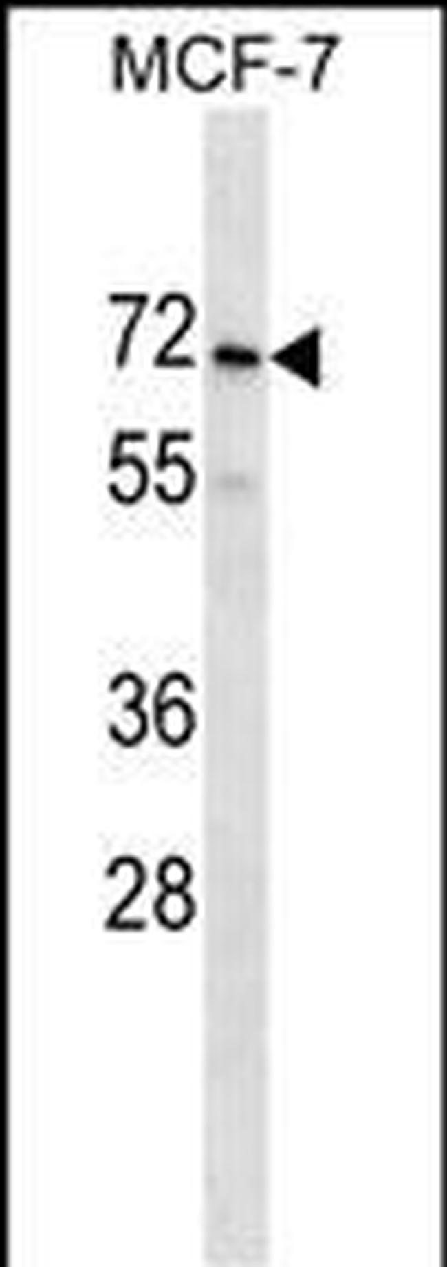 PRAMEF2 Antibody in Western Blot (WB)