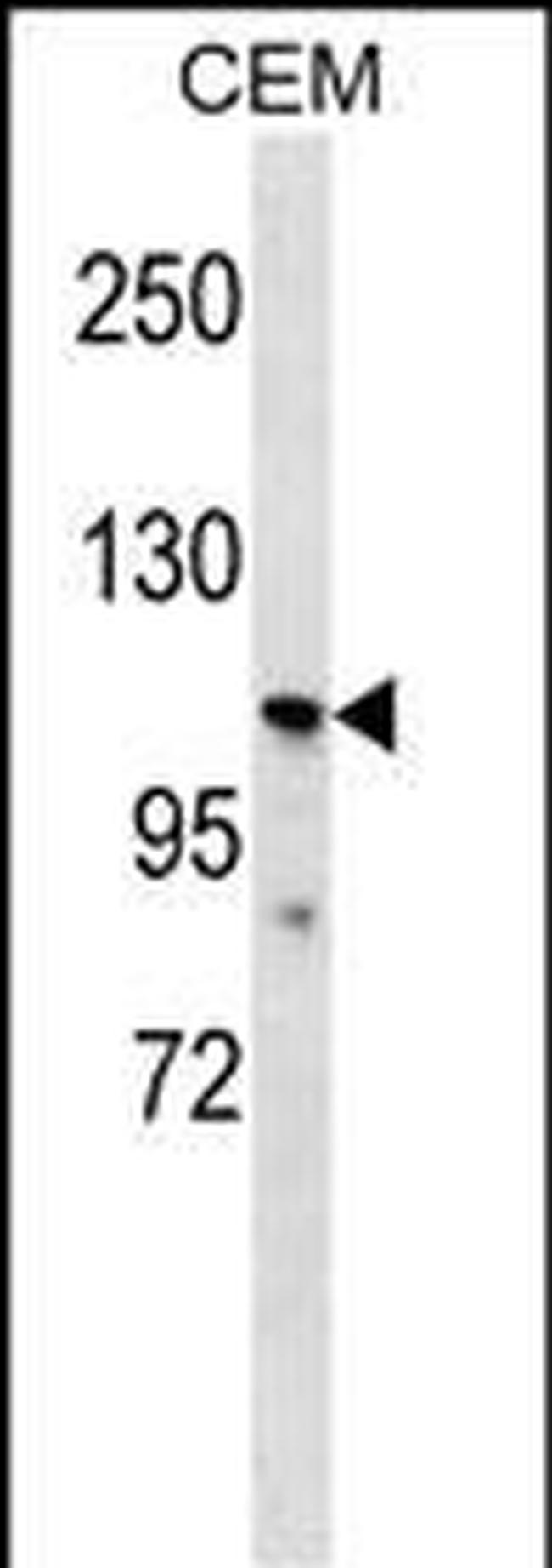 PK2L1 Antibody in Western Blot (WB)