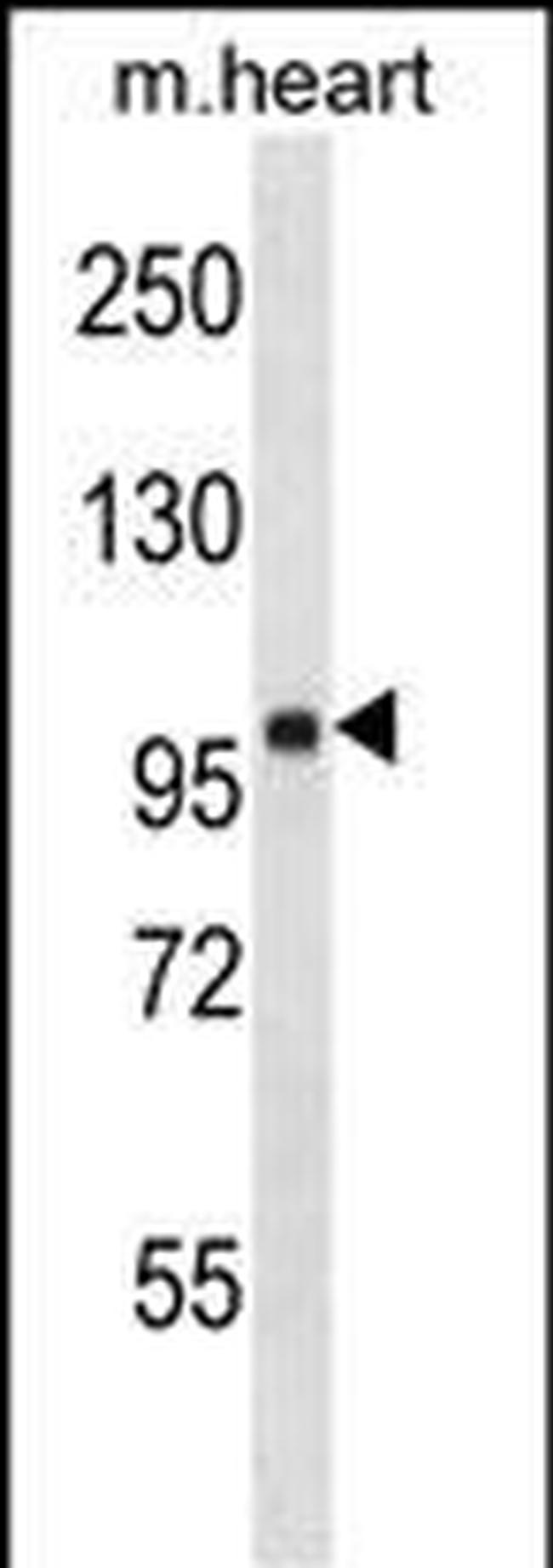FHOD1 Antibody in Western Blot (WB)