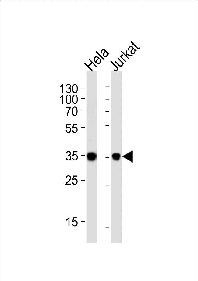 FRG1 Antibody in Western Blot (WB)