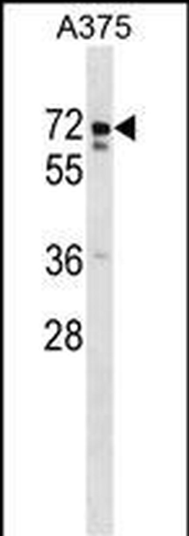 USP17L2 Antibody in Western Blot (WB)