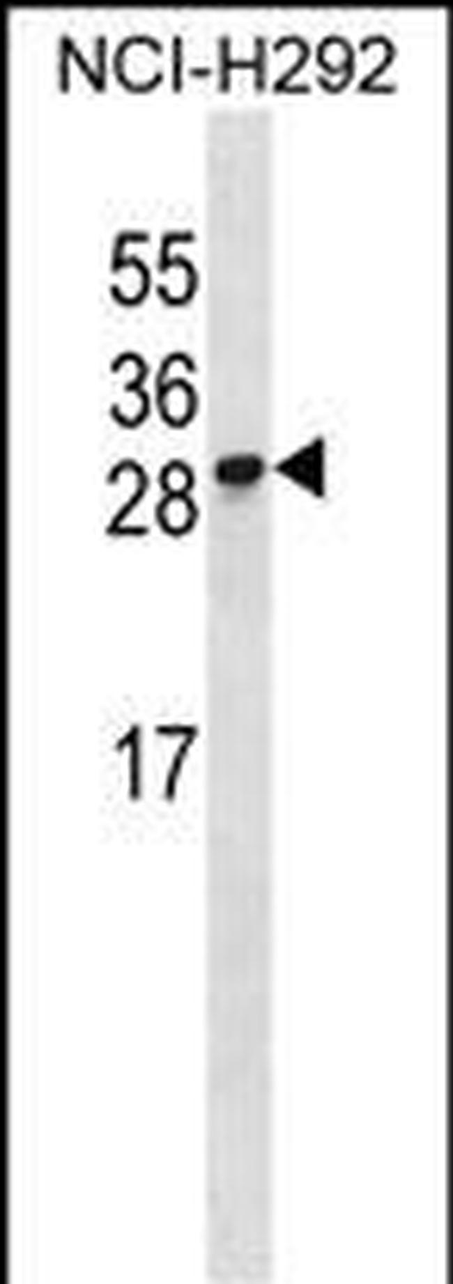 RFESD Antibody in Western Blot (WB)