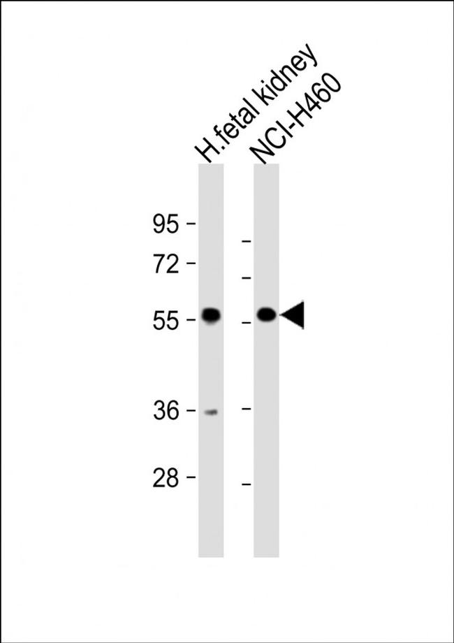 XKRX Antibody in Western Blot (WB)