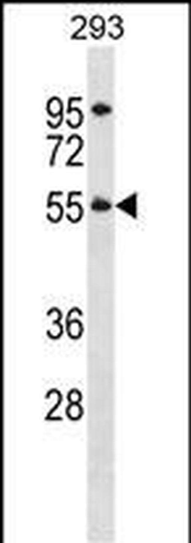 TTC8 Antibody in Western Blot (WB)