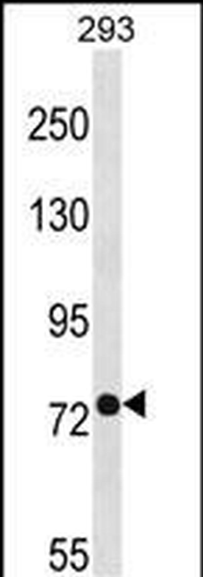 PHEX Antibody in Western Blot (WB)