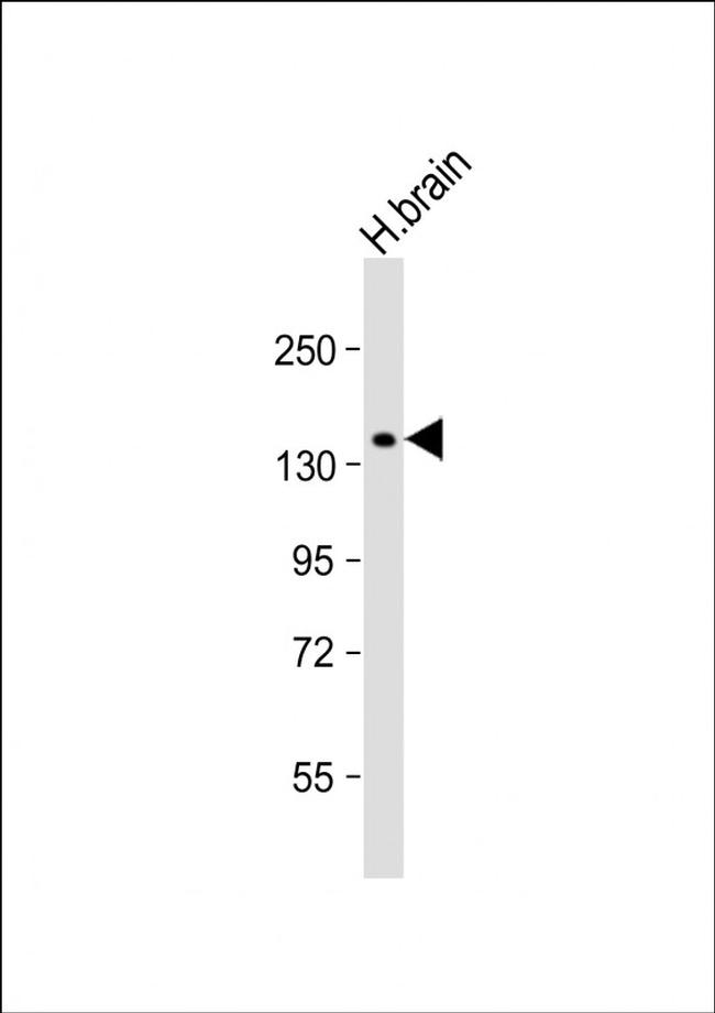 MTMR4 Antibody in Western Blot (WB)