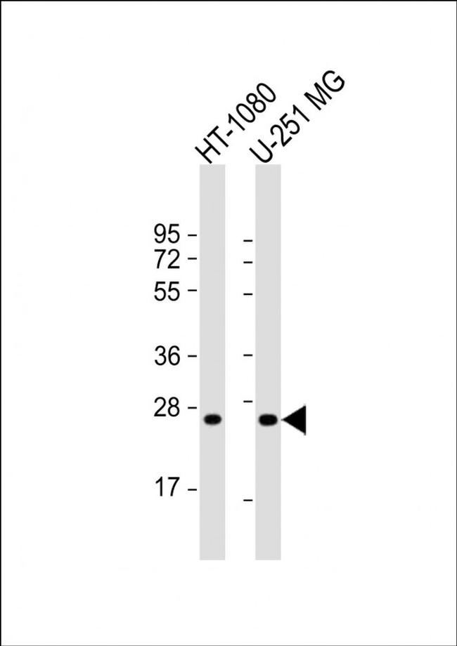 ULBP2 Antibody in Western Blot (WB)