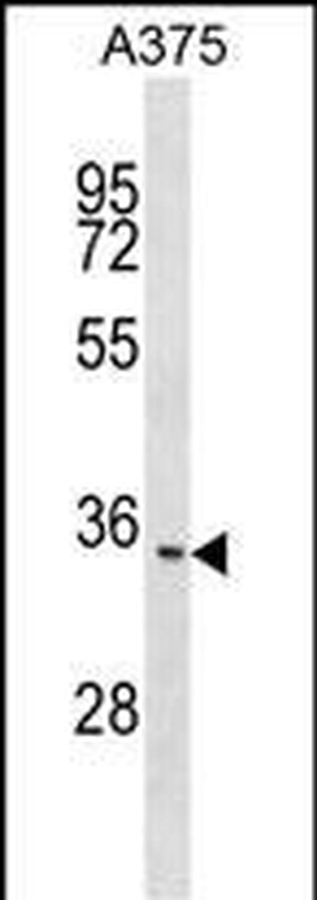 ITM2C Antibody in Western Blot (WB)