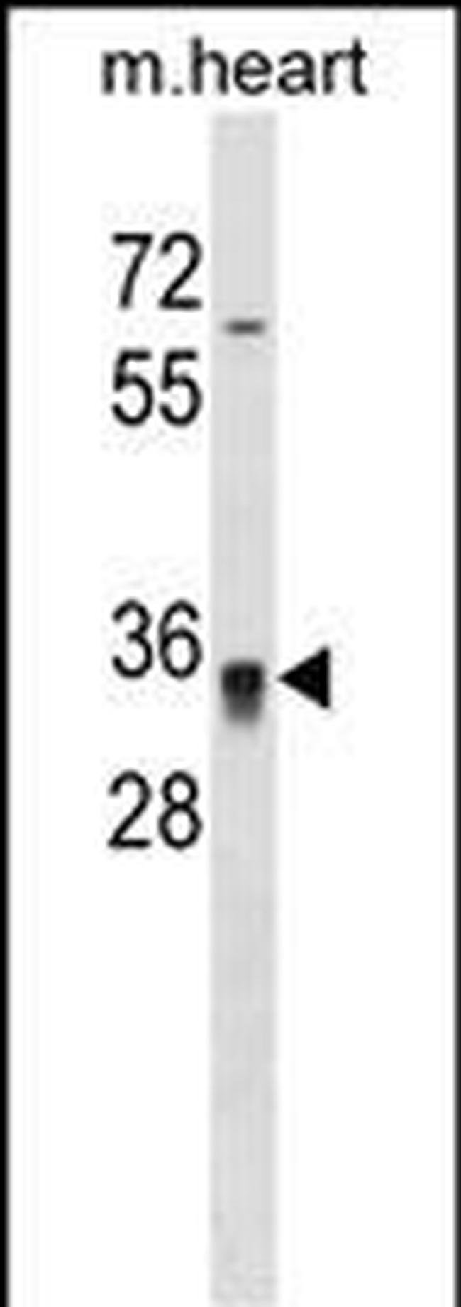 HOXC8 Antibody in Western Blot (WB)
