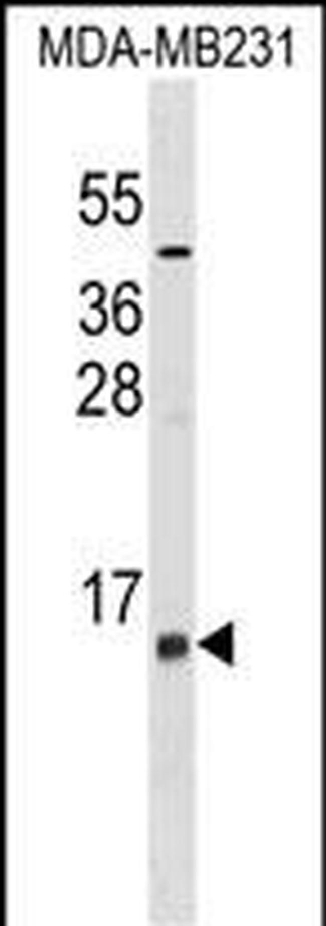 LST1 Antibody in Western Blot (WB)