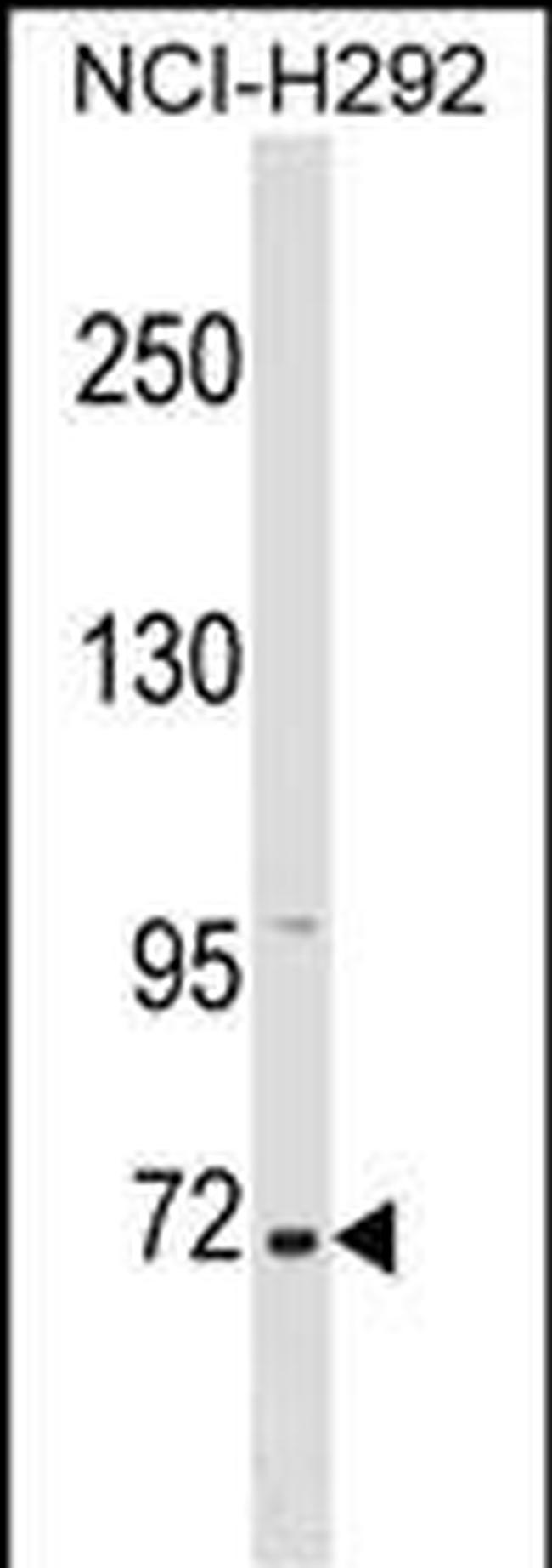 ZNF571 Antibody in Western Blot (WB)