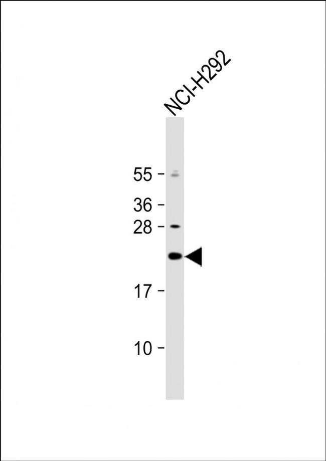 DNAJC5G Antibody in Western Blot (WB)