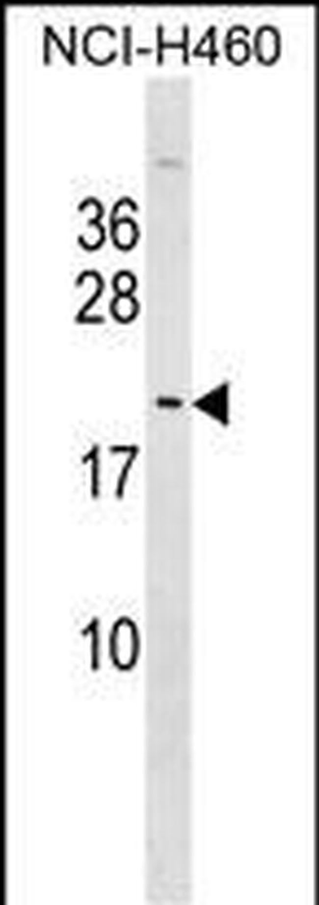 MPLKIP Antibody in Western Blot (WB)