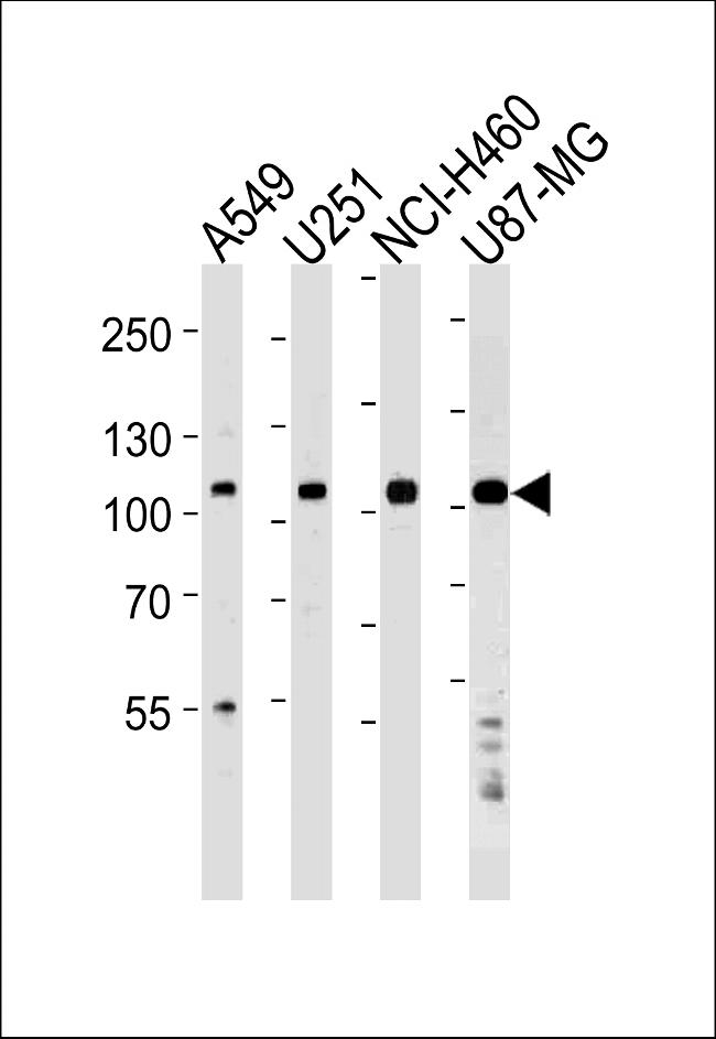 ZNF41 Antibody in Western Blot (WB)
