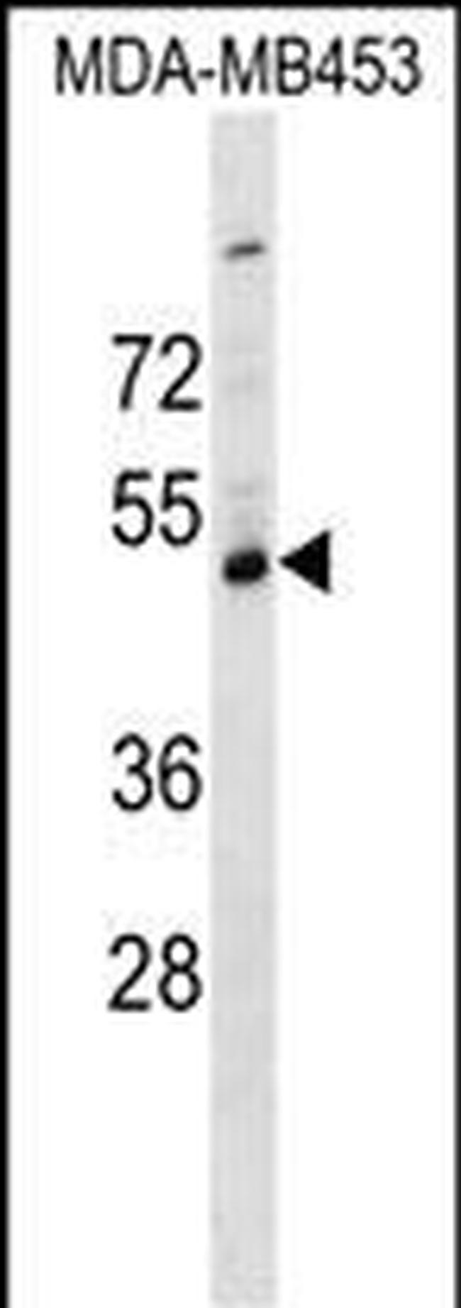SERPINI2 Antibody in Western Blot (WB)