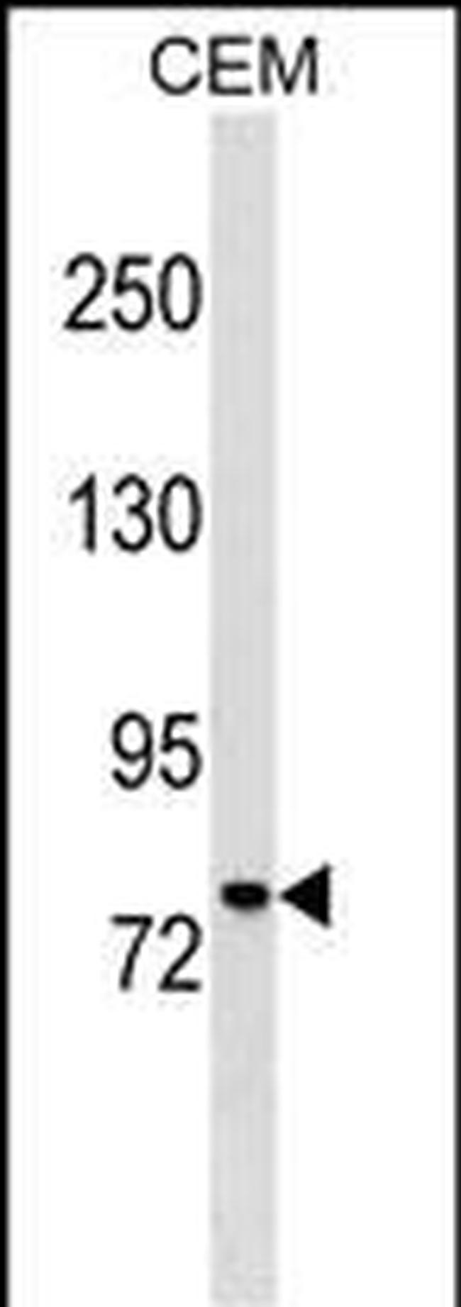 MUM1 Antibody in Western Blot (WB)