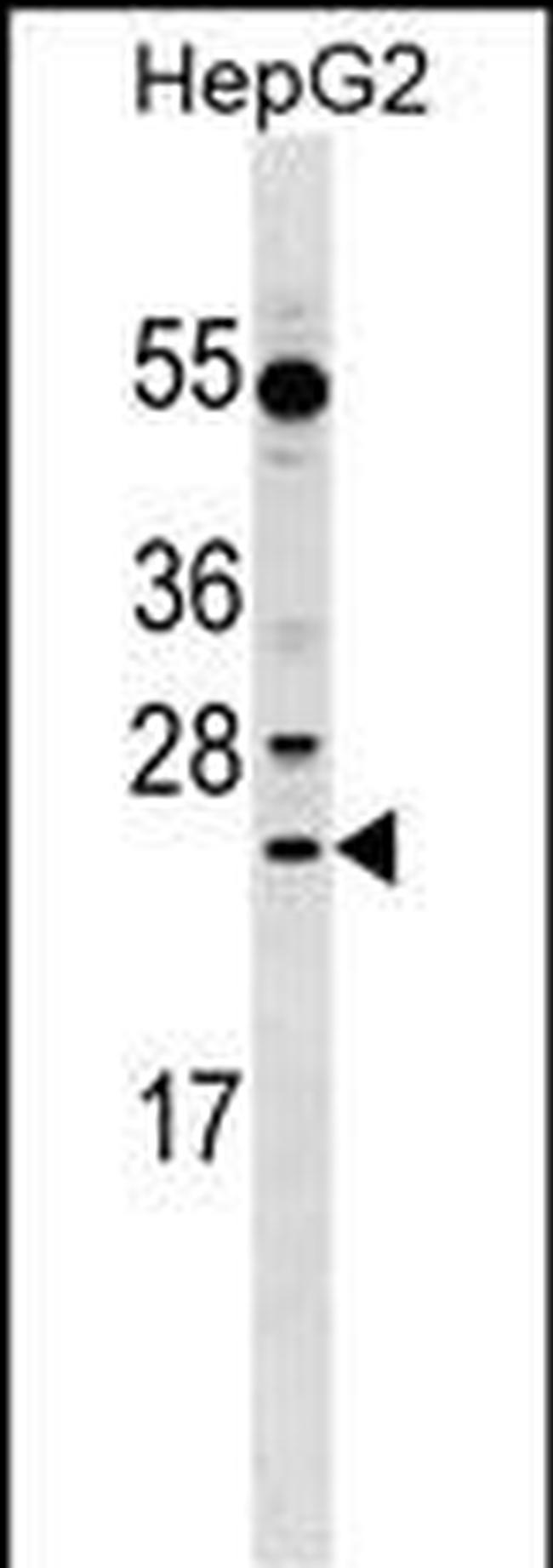 LRRC29 Antibody in Western Blot (WB)